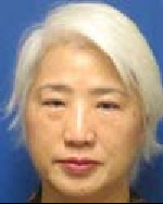 Image of Dr. Beelein Lin, MD